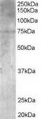 MAGUK p55 subfamily member 5 antibody, TA302911, Origene, Western Blot image 