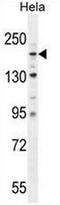 Collagen Type IV Alpha 2 Chain antibody, AP51015PU-N, Origene, Western Blot image 