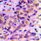 Akt antibody, LS-C354521, Lifespan Biosciences, Immunohistochemistry paraffin image 