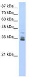 Zinc Finger Protein 197 antibody, TA343652, Origene, Western Blot image 