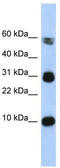 Fatty Acid Binding Protein 4 antibody, TA334715, Origene, Western Blot image 