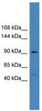 Ubiquitin carboxyl-terminal hydrolase 20 antibody, TA342571, Origene, Western Blot image 