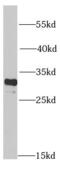 Proteasome subunit alpha type-4 antibody, FNab06864, FineTest, Western Blot image 