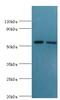 Delta-1-pyrroline-5-carboxylate dehydrogenase, mitochondrial antibody, LS-C375185, Lifespan Biosciences, Western Blot image 