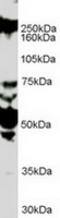 Roundabout Guidance Receptor 1 antibody, TA303077, Origene, Western Blot image 