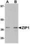 Zinc transporter ZIP1 antibody, LS-C115932, Lifespan Biosciences, Western Blot image 