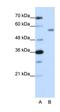 Zinc Finger Protein 497 antibody, orb324828, Biorbyt, Western Blot image 