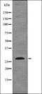 Sodium Channel Epithelial 1 Gamma Subunit antibody, orb339208, Biorbyt, Western Blot image 
