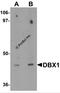 Homeobox protein DBX1 antibody, 6455, ProSci, Western Blot image 