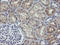 Ubiquitin Conjugating Enzyme E2 G2 antibody, LS-C337846, Lifespan Biosciences, Immunohistochemistry frozen image 