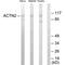 Actinin Alpha 2 antibody, PA5-49802, Invitrogen Antibodies, Western Blot image 