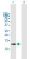 Zinc Finger SWIM-Type Containing 7 antibody, H00125150-B01P, Novus Biologicals, Western Blot image 