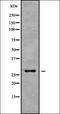 RAB11B, Member RAS Oncogene Family antibody, orb378389, Biorbyt, Western Blot image 