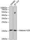 Histone H2B antibody, 18-414, ProSci, Western Blot image 