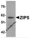 Zinc transporter ZIP5 antibody, 6089, ProSci Inc, Western Blot image 