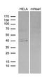 BAF Chromatin Remodeling Complex Subunit BCL7B antibody, LS-C794956, Lifespan Biosciences, Western Blot image 