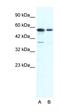 X-Ray Repair Cross Complementing 6 antibody, orb324513, Biorbyt, Western Blot image 