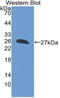 BH3 Interacting Domain Death Agonist antibody, LS-C314202, Lifespan Biosciences, Western Blot image 