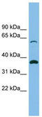 ADP/ATP translocase 1 antibody, TA334077, Origene, Western Blot image 