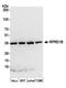 Regulation Of Nuclear Pre-MRNA Domain Containing 1B antibody, A303-782A, Bethyl Labs, Western Blot image 
