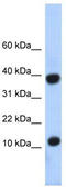 Pterin-4 Alpha-Carbinolamine Dehydratase 1 antibody, TA330545, Origene, Western Blot image 