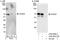 Papillary thyroid carcinoma-encoded protein antibody, A302-096A, Bethyl Labs, Immunoprecipitation image 