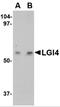 Leucine-rich repeat LGI family member 4 antibody, 4513, ProSci Inc, Western Blot image 