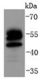 Forkhead Box O4 antibody, NBP2-67798, Novus Biologicals, Western Blot image 