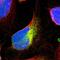 Vesicle-associated membrane protein-associated protein B antibody, PA5-53023, Invitrogen Antibodies, Immunofluorescence image 