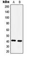 5-hydroxytryptamine receptor 4 antibody, orb214073, Biorbyt, Western Blot image 