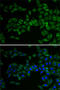 E2F Transcription Factor 6 antibody, LS-C746823, Lifespan Biosciences, Immunofluorescence image 
