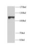 Nucleolin antibody, FNab05587, FineTest, Western Blot image 