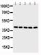 Branched Chain Amino Acid Transaminase 2 antibody, PA5-78860, Invitrogen Antibodies, Western Blot image 