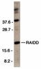 CASP2 And RIPK1 Domain Containing Adaptor With Death Domain antibody, orb74317, Biorbyt, Western Blot image 