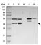 Protein FAM110B antibody, PA5-52543, Invitrogen Antibodies, Western Blot image 