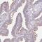 Zinc Finger B-Box Domain Containing antibody, NBP2-38294, Novus Biologicals, Immunohistochemistry frozen image 