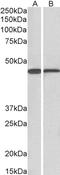 Sterol O-acyltransferase 1 antibody, STJ72089, St John