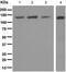 UPF1 RNA Helicase And ATPase antibody, ab109363, Abcam, Western Blot image 