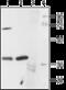 5-Hydroxytryptamine Receptor 1A antibody, GTX02545, GeneTex, Western Blot image 