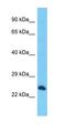 Replication Termination Factor 2 antibody, orb327205, Biorbyt, Western Blot image 