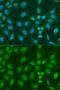 PHD Finger Protein 21B antibody, GTX32789, GeneTex, Immunofluorescence image 
