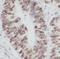 Chaperonin Containing TCP1 Subunit 3 antibody, FNab01397, FineTest, Immunohistochemistry paraffin image 