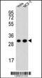 Cytochrome C1 antibody, MBS9208212, MyBioSource, Western Blot image 