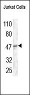 Decapping MRNA 2 antibody, 252209, Abbiotec, Western Blot image 