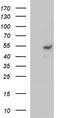Matrix Metallopeptidase 13 antibody, TA506804BM, Origene, Western Blot image 