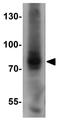 Actin Filament Associated Protein 1 Like 1 antibody, GTX32040, GeneTex, Western Blot image 