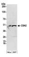 COP9 Signalosome Subunit 2 antibody, A300-027A, Bethyl Labs, Western Blot image 
