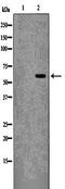 FYN Proto-Oncogene, Src Family Tyrosine Kinase antibody, orb99327, Biorbyt, Western Blot image 
