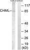 CHM Like Rab Escort Protein antibody, TA313621, Origene, Western Blot image 