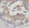 Ubiquilin 1 antibody, FNab09196, FineTest, Immunohistochemistry paraffin image 